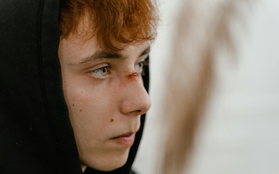 jongen-met-wonde-aan-neus