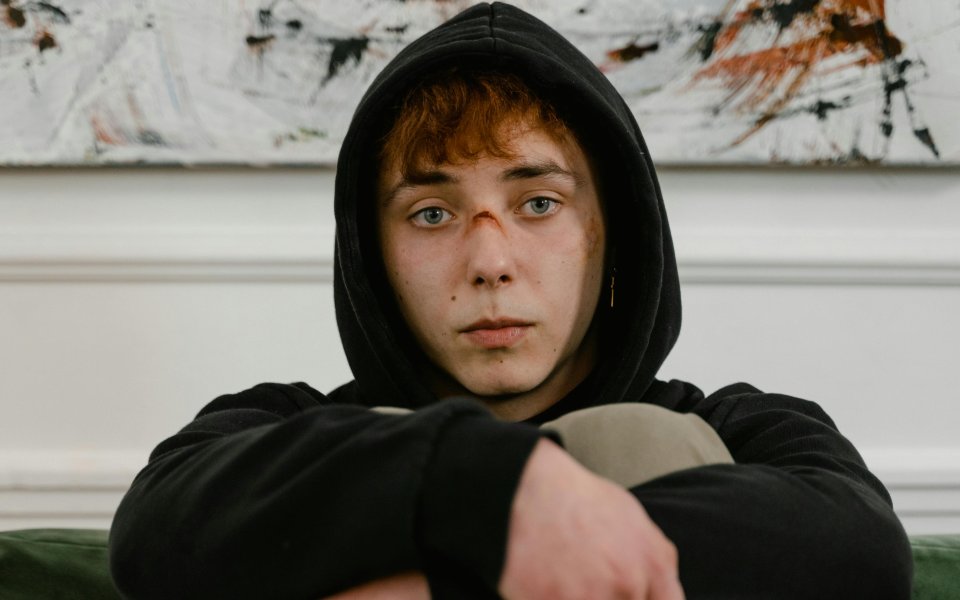 jongere-in-hoodie--met-wonde-in-gezicht--zit-met-opgetrokken-knieen